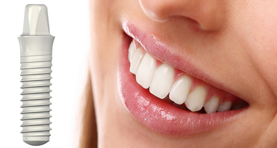 zirconia-dental-implants-bostondentalwellness